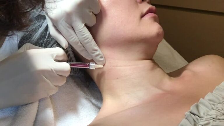 What is jawline filler and what are its benefits?